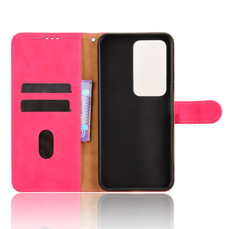 Peňaženkové puzdro Solid ružové – Xiaomi Redmi 15 4G/5G | Lacné Kryty Lacné Kryty | Peňaženkové puzdro Solid ružové – Xiaomi Redmi 15 4G/5G | Lacné Kryty